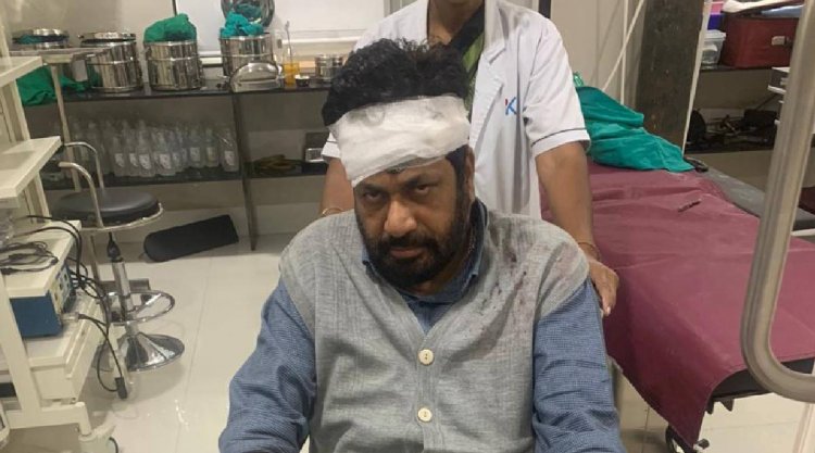 आमदार बच्चू कडू यांचा अपघात.! रस्ता ओलांडताना  दुचाकीने दिली धडक...