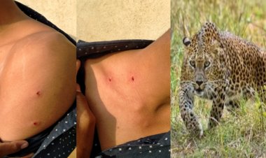 कोराटे येथे बिबट्याचा तरुणावर हल्ला, शेतकऱ्यांमध्ये भीतीचे वातावरण...